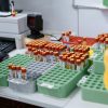 Blood samples in a lab, ready for testing and research. Organized for efficient processing.